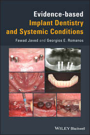 бесплатно читать книгу Evidence-based Implant Dentistry and Systemic Conditions автора Georgios Romanos