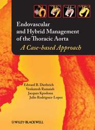 бесплатно читать книгу Endovascular and Hybrid Management of the Thoracic Aorta автора Jacques Kpodonu