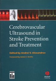 бесплатно читать книгу Cerebrovascular Ultrasound in Stroke Prevention and Treatment автора Andrei Alexandrov