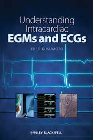 бесплатно читать книгу Understanding Intracardiac EGMs and ECGs автора 