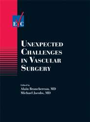 бесплатно читать книгу Unexpected Challenges in Vascular Surgery автора Michael Jacobs