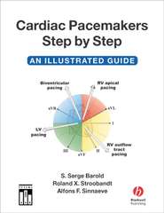 бесплатно читать книгу Cardiac Pacemakers Step-by-Step автора Roland Stroobandt