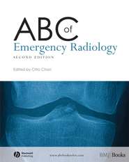 бесплатно читать книгу ABC of Emergency Radiology автора 