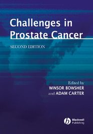 бесплатно читать книгу Challenges in Prostate Cancer автора Winsor Bowsher