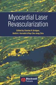 бесплатно читать книгу Myocardial Laser Revascularization автора Charles Bridges