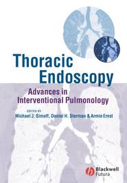 бесплатно читать книгу Thoracic Endoscopy автора Armin Ernst