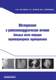 бесплатно читать книгу Обследование и рентгенохирургическое лечение больных после операции аортокоронарного шунтирования автора Валентин Синицын