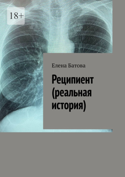 Реципиент (реальная история)