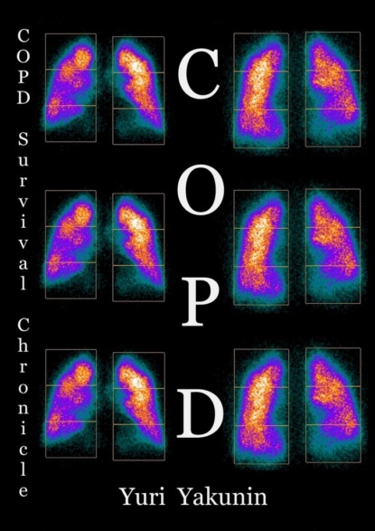 COPD