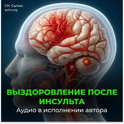 Выздоровление после инсульта. Все мозговые центры успокаиваются